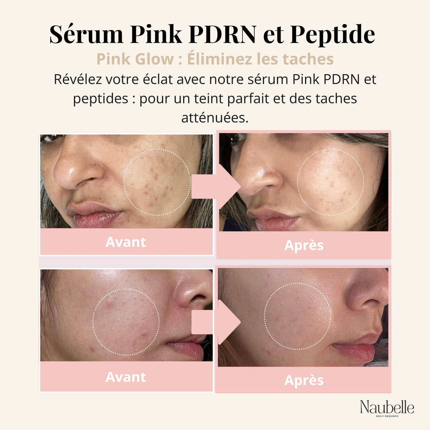 Soin intensif anti-âge sérum peptides