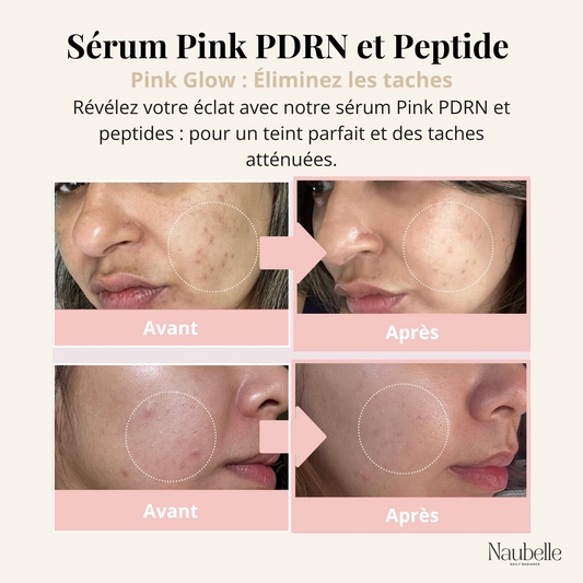 Soin complet (4 masques, Sérum & Lotion tonique) au Pink PDRN et collagène